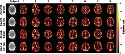 Dependence of resting-state-based cerebrovascular reactivity (CVR) mapping on spatial resolution